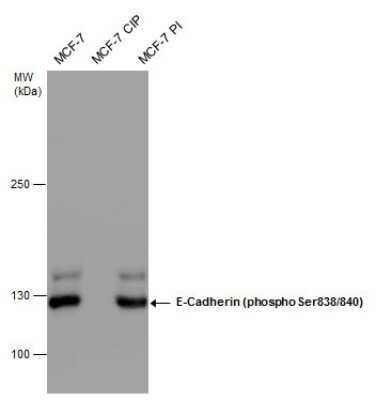 Western Blot: E-Cadherin [p Ser838, p Ser840] Antibody [NBP3-12922] - E-Cadherin (phospho Ser838/840) antibody detects E-Cadherin (phospho Ser838/840) protein by western blot analysis. MCF-7 whole cell extract (30 ug) with the indicated treatments were separated by 5% SDS-PAGE, and the membrane was blotted with E-Cadherin (phospho Ser838/840) antibody (NBP3-12922) at a dilution of 1:10000.